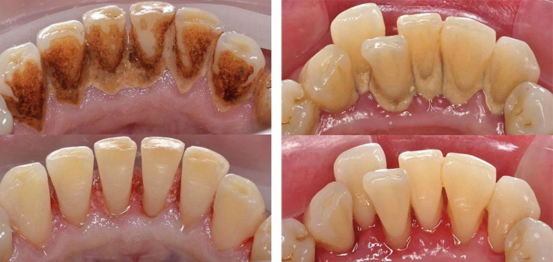 Casos Periodoncia